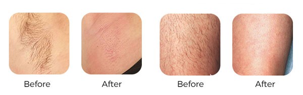 f5d74ae417a79d8f9ecd52c61156a46e f5d74ae417a79d8f9ecd52c61156a46e