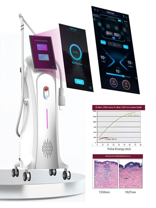 1927nm laser 1927nm laser